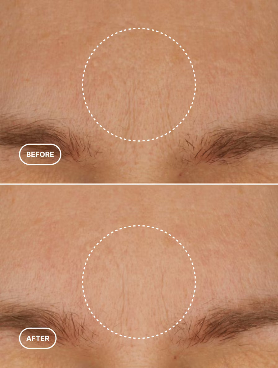 Retinol Alternative Moisturiser