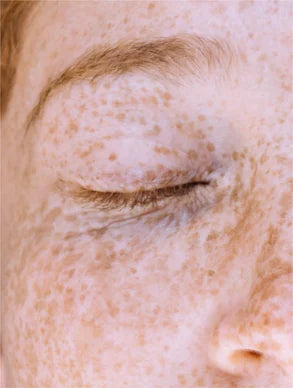 Vitamin C Serum Anti-Age